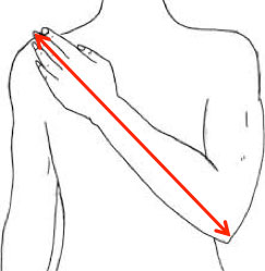 luxarm shoulder subluxation brace arm measurement